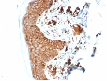 B2M Antibody