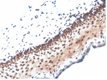NME1 Antibody