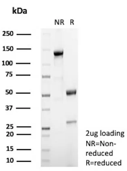 NR5A1 Antibody