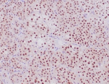 NR5A1 Antibody