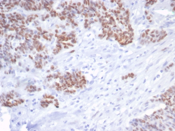 TP53 Antibody
