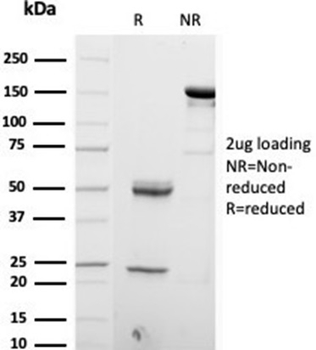 S100B Antibody