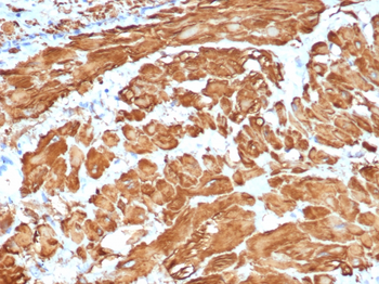 ACTA2 Antibody