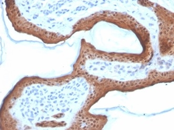 SERPINB5 Antibody