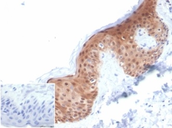 SERPINB5 Antibody