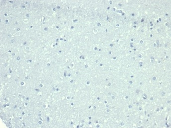 MME Antibody