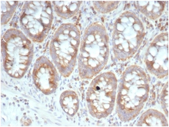 RPSA Antibody