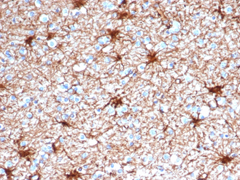 GFAP Antibody
