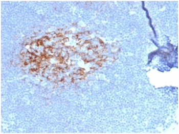 FCER2 Antibody
