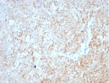 DES Antibody