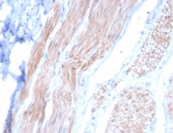 DES Antibody