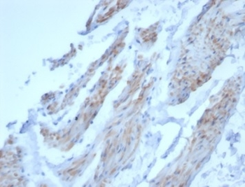 DES Antibody