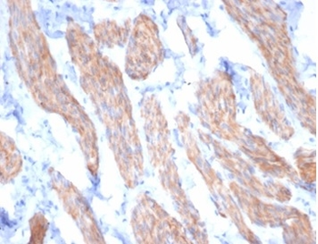DES Antibody