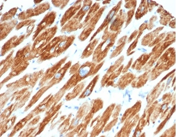 DES Antibody