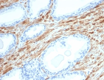 DES Antibody