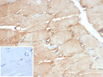 DES Antibody