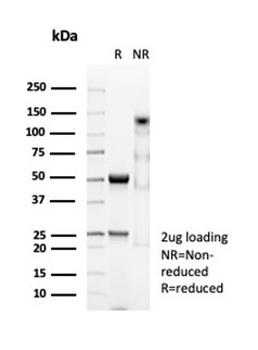 DES Antibody