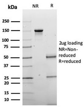 CHGA Antibody