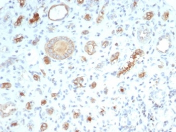 CFTR Antibody