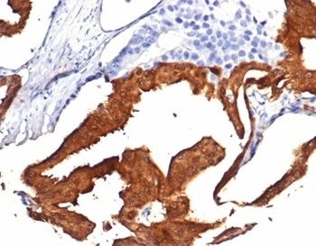 IDH1 Antibody