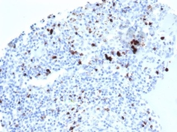 TIA1 Antibody