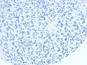 TIA1 Antibody