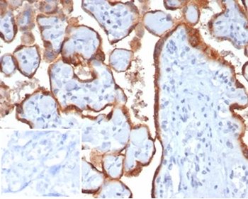 CGB3, CGB5, CGB8, NA Antibody