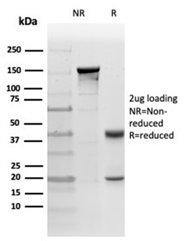PRKCI Antibody