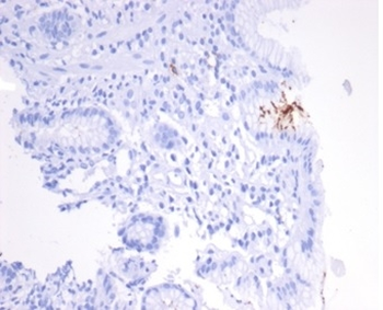 Helicobacter pylori (Catalase) Antibody