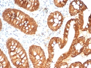 CDH1 Antibody