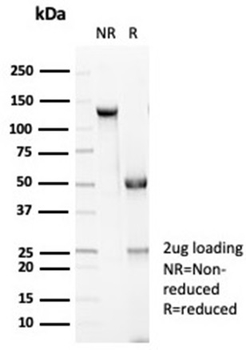 CDH1 Antibody