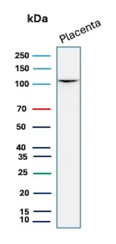 CDH1 Antibody