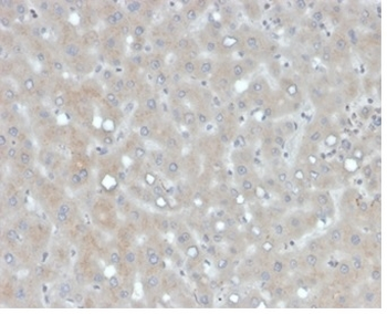 APOB Antibody