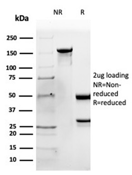 APOB Antibody