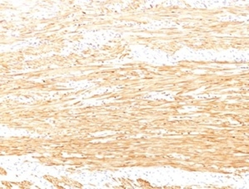 SMTN Antibody
