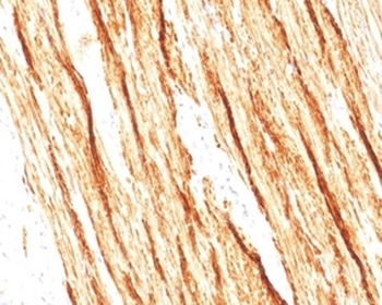SMTN Antibody