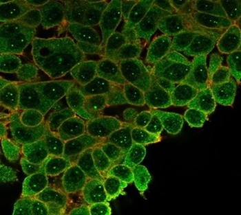 SP100 Antibody