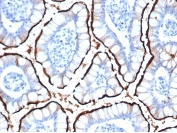 ACE2 Antibody