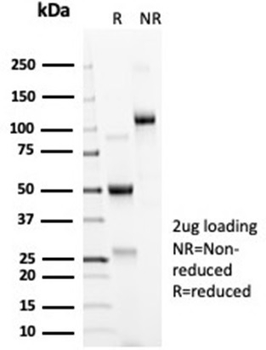 ACE2 Antibody