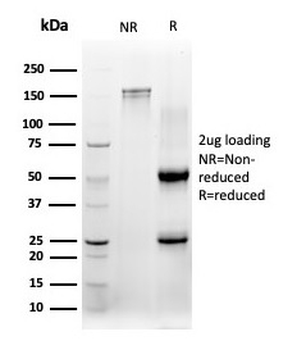 CBFB Antibody