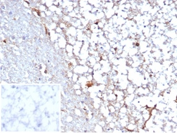 STAT6 Antibody