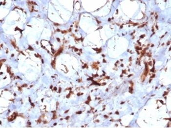 STAT6 Antibody