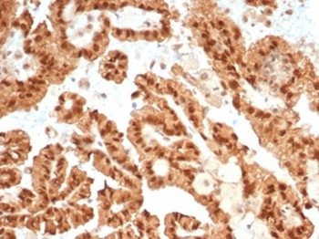 STAT6 Antibody