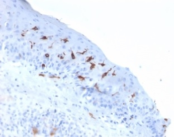 CD1A Antibody