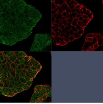 BCL2L2 Antibody