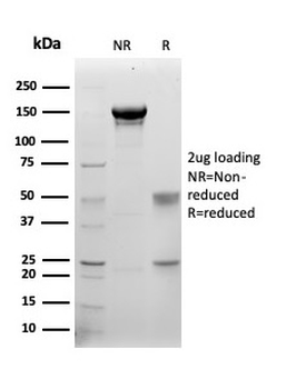 S100B Antibody