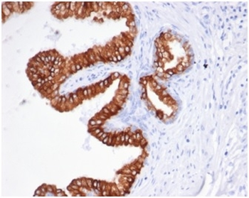 EPCAM Antibody