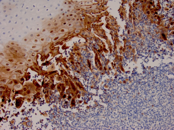 Recombinant HSV1 (Herpes Simplex Virus Type I) Antibody