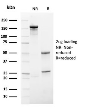 Recombinant HSV1 (Herpes Simplex Virus Type I) Antibody