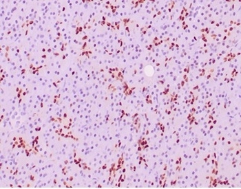 SOX9 Antibody